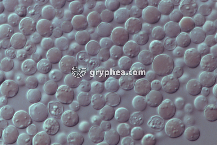 Levures mutées (Saccharomyces cerevisiae Ade2) x400 - gryphea.com